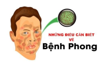Nguyên nhân và dấu hiệu nhận biết của bệnh phong